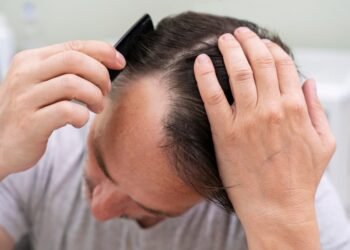 How Hair Transplant Restores Thinning Hair